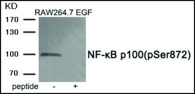 Anti-phospho-NF-?B p100 (pSer??²) antibody produced