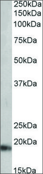 Anti-NPPA (C-terminal) antibody produced in