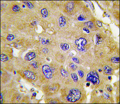 Anti-ALDH6A1 (N-term) antibody produced in