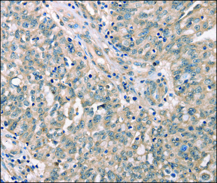 Anti-CDK12 antibody produced in rabbit