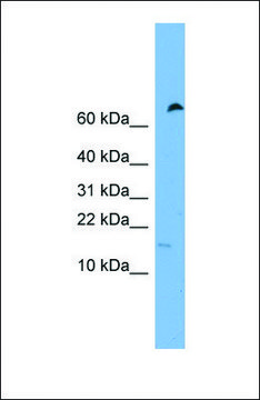 Anti-IFITM5 antibody produced in rabbit