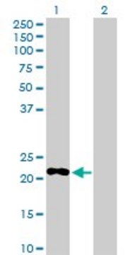 Anti-PDE4DIP antibody produced in rabbit