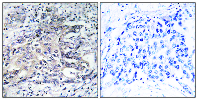 Anti-Cytochrome P450 4X1 antibody produced