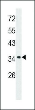 ANTI-ANNEXIN A1 (CENTER) antibody produced