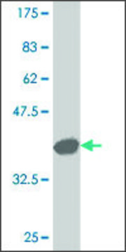 ANTI-LBX1 antibody produced in mouse