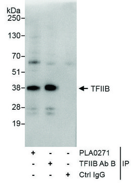 Rabbit anti-GTF2B/TFIIB Antibody, Affinity Purified