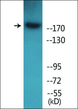 Anti-phospho-ALK (pTyr¹???) antibody produced in
