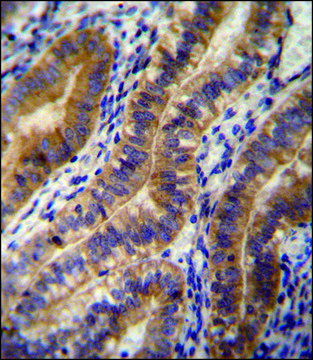ANTI-ANGPT2 (C-TERM) antibody produced in