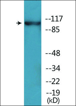 Anti-phospho-ACK1 (pTyr²??) antibody produced in