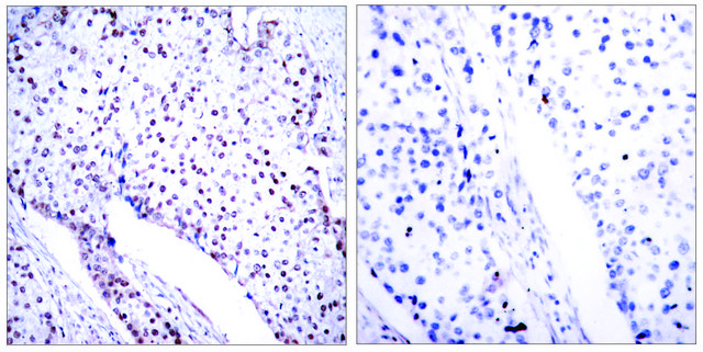 Anti-STAT3 (Ab-705) antibody produced in
