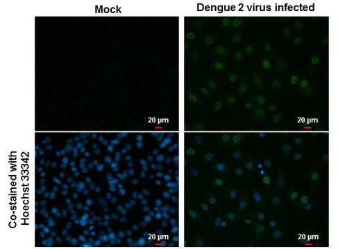 Monoclonal Anti-Dengue virus Type 2