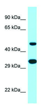 Anti-SCD5 (C-terminal) antibody produced in