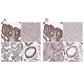 Anti-FMR1 antibody produced in rabbit