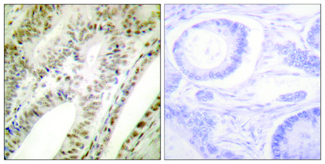 Anti-PML antibody produced in rabbit