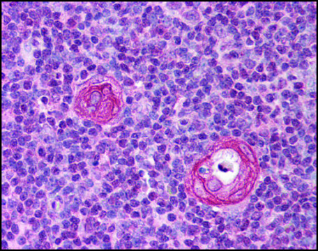 Anti-VISA (AB2) antibody produced in
