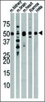 Anti-Drosophila Parkin (N-term) antibody produced