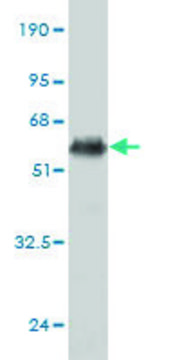 Monoclonal Anti-TNF antibody produced in