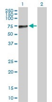 Anti-ALPP antibody produced in rabbit
