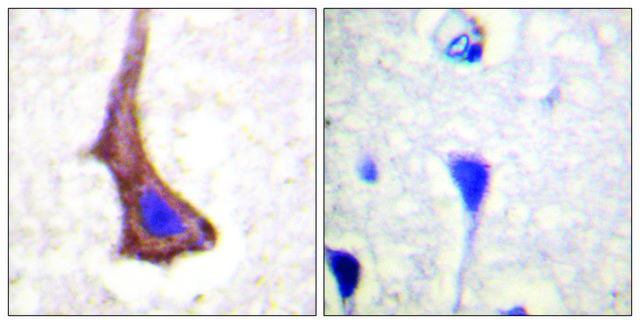 Anti-CSFR antibody produced in rabbit