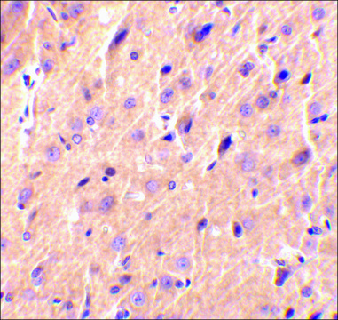 Anti-Precerebellin (ab2) antibody produced in
