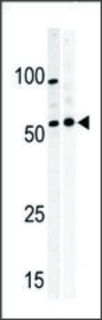 Anti-PKMYT1 (C-term) antibody produced in