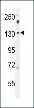 ANTI-POTEF (CENTER) antibody produced in