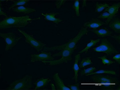 Anti-DTNA antibody produced in mouse