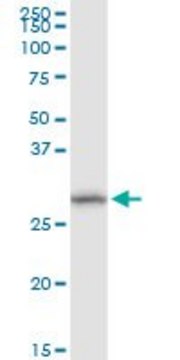 Anti-DHRS11 antibody produced in rabbit