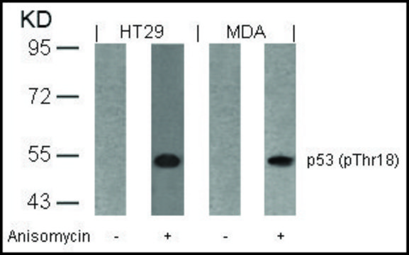 Anti-phospho-TP53 (pThr¹?) antibody produced in
