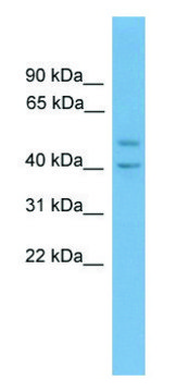 Anti-INHBA (N-terminal) antibody produced in