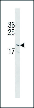 ANTI-GP9 (C-TERM) antibody produced in