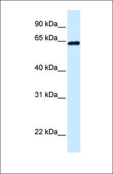 Anti-LCP1 (ab2) antibody produced in
