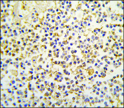 Anti-ALDH1A3 (N-term) antibody produced in