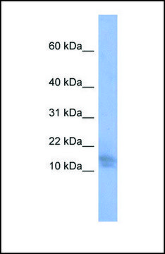 Anti-BRWD1, (N-terminal) antibody produced in