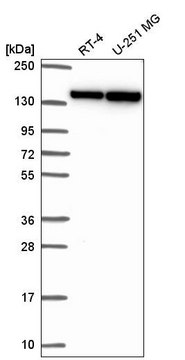 Anti-DHX9 antibody produced in rabbit