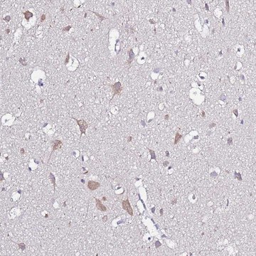 Anti-GLCE antibody produced in rabbit