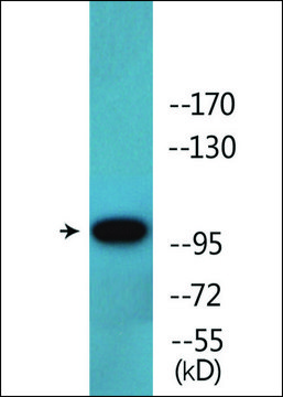 Anti-phospho-c-Kit (pTyr?²¹) antibody produced in