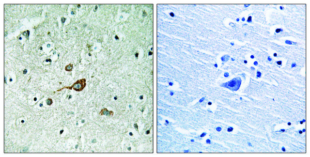 Anti-C-ABL antibody produced in rabbit