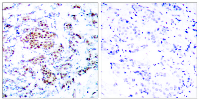 Anti-STAT5A, C-Terminal antibody produced in