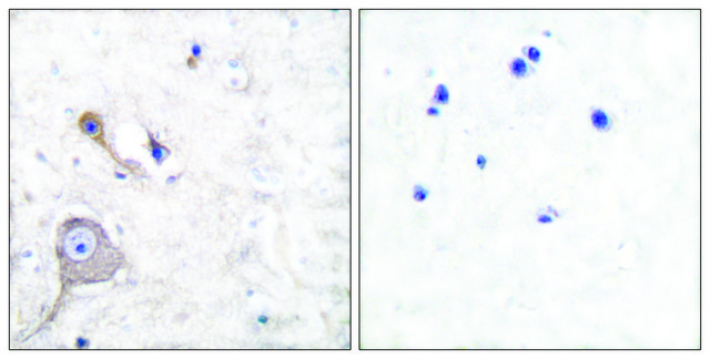 Anti-S100 A1, N-Terminal antibody produced