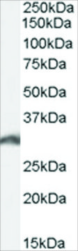 Anti-PSME3 antibody produced in goat