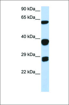 Anti-SNRPB antibody produced in rabbit