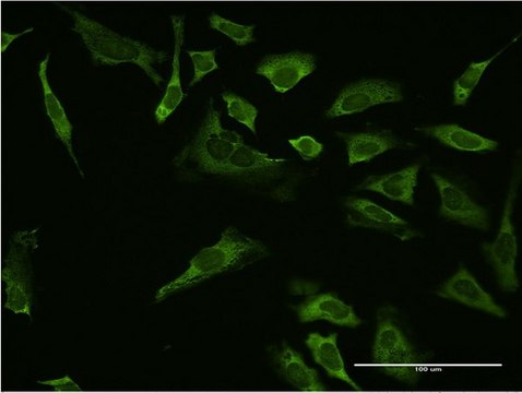 ANTI-SP1 antibody produced in mouse