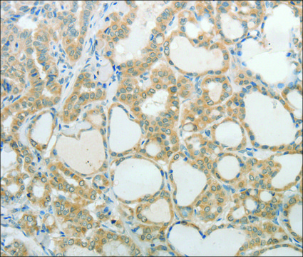 Anti-UCN antibody produced in rabbit