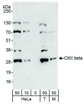 Rabbit anti-CKII beta Antibody, Affinity
