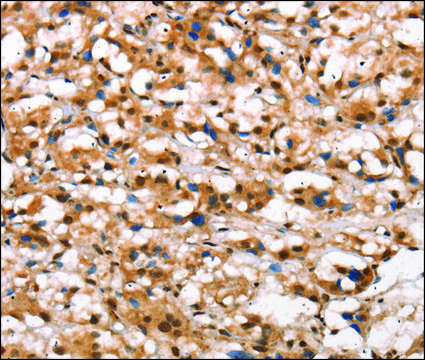 Anti-DGAT1 antibody produced in rabbit
