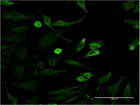 ANTI-HD antibody produced in mouse