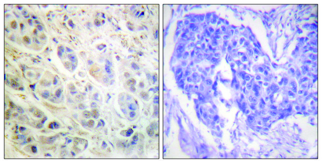 Anti-p90 RSK, C-Terminal antibody produced