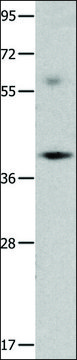 Anti-OPCML antibody produced in rabbit