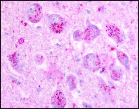 Anti-GPR21 (AB1) antibody produced in